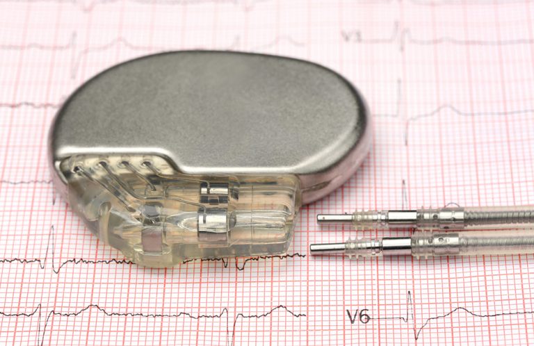 Pacemaker Clinic | CardioVascular Specialists And Vanishing Veins Ohio